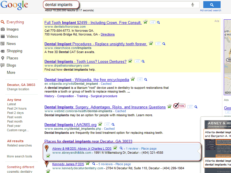 SEO Internet Marketing